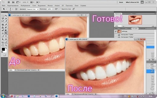 МК как отбелить зубы в фотошопе (фото 7)
